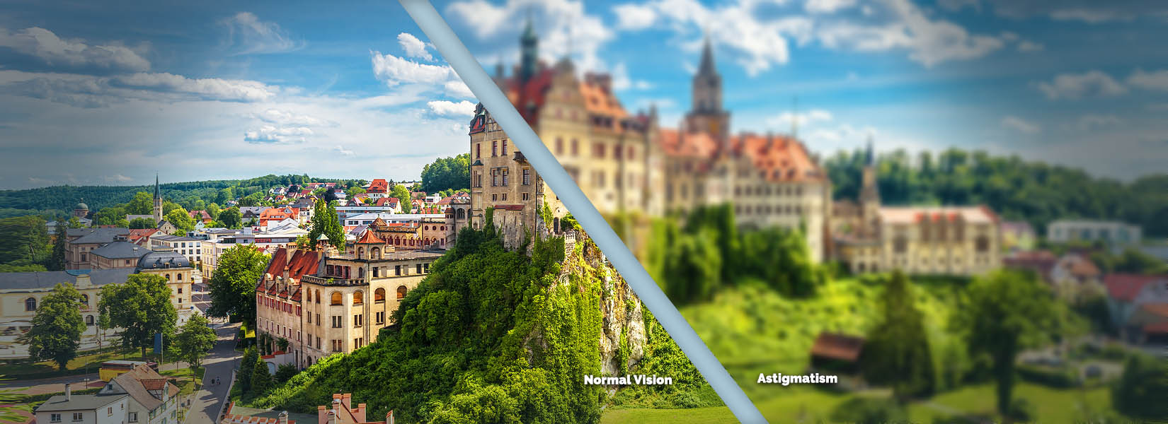 Astigmatism Treatment in Castle Rock
