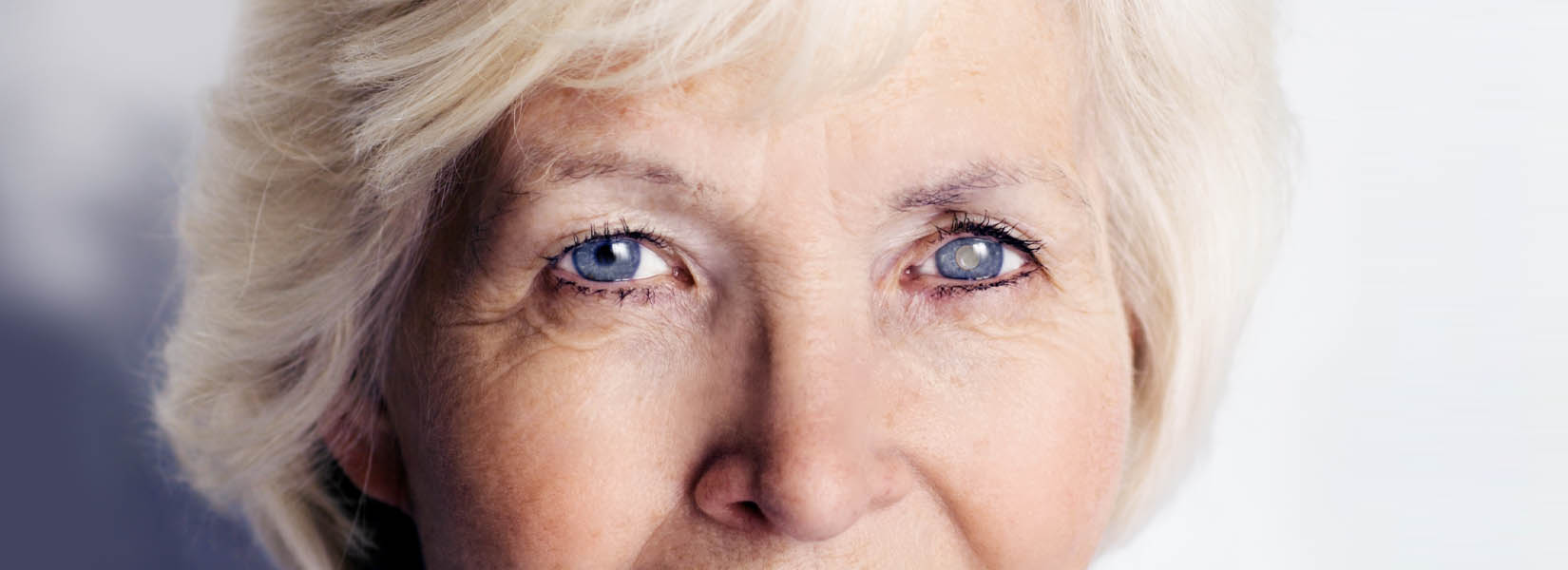 Cataract Surgery in Castle Rock