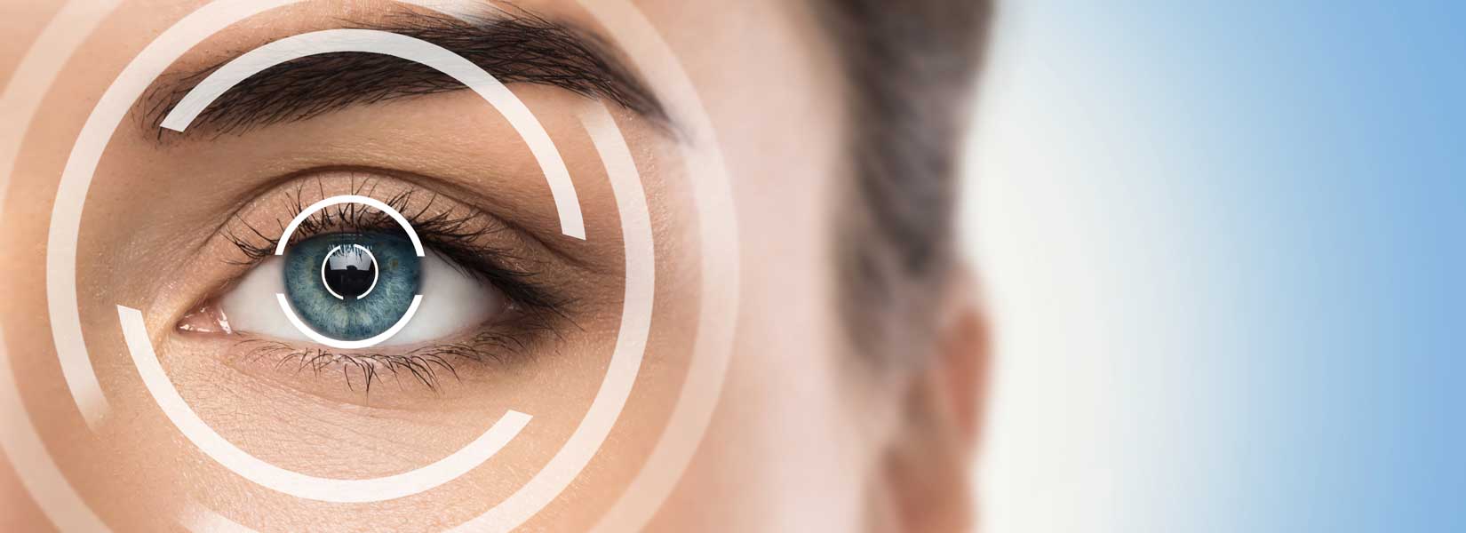 LASIK & Refractive Surgery Co-Management in Castle Rock